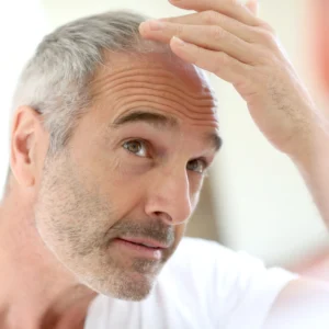 Hair Transplantation and Age: Which Age Group is Suitable?